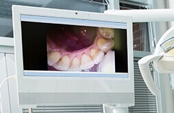 Screen showing Intra-oral Camera picture