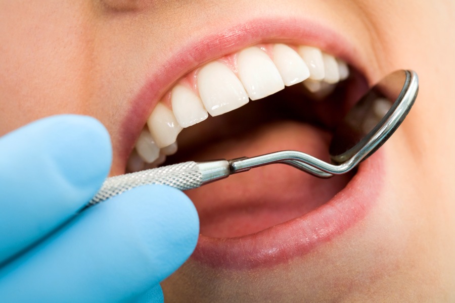 Closeup of a woman getting a dental checkup at the dentist in Long Island City, NY, to check for cavities