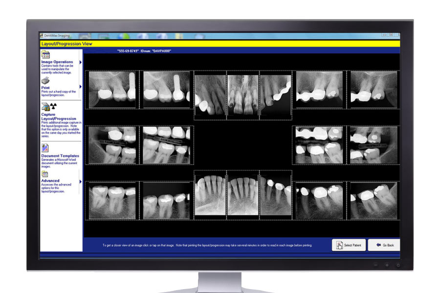 Picture of a computer screen showing digital X-ray images.