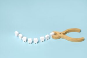 wisdom tooth extraction